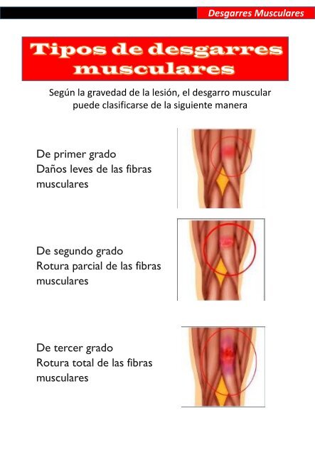 Lesiones deportivas