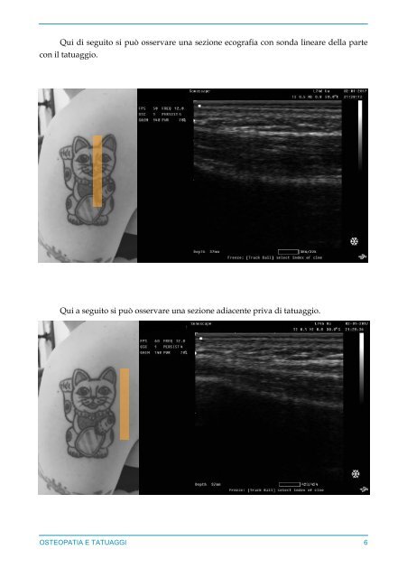 Osteopatia e Tatuaggi