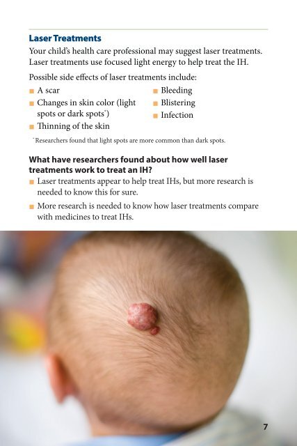 Treating Infantile Hemangiomas in Children