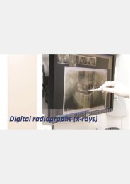 digital dental x-rays