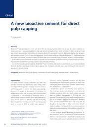 A new bioactive cement for direct pulp capping - Modern Dentistry ...