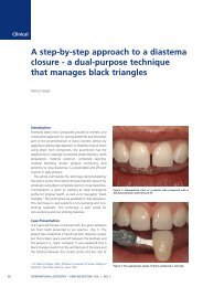 A step-by-step approach to a diastema closure - Modern Dentistry ...