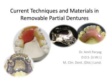 surgical treatment of pancreatic