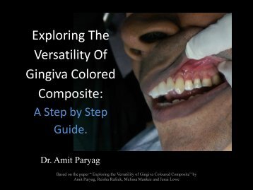 Exploring the versatility of Gingiva Coloured Composite and a step by step guide