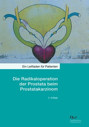 Die Radikaloperation der Prostata beim ... - Prostata.de