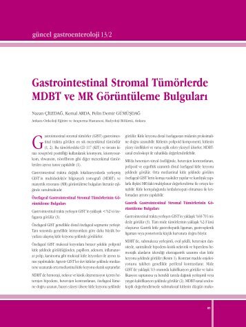 Gastrointestinal Stromal Tümörlerde MDBT ve MR Görüntüleme ...