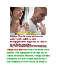 Vitiligo Skin Disease