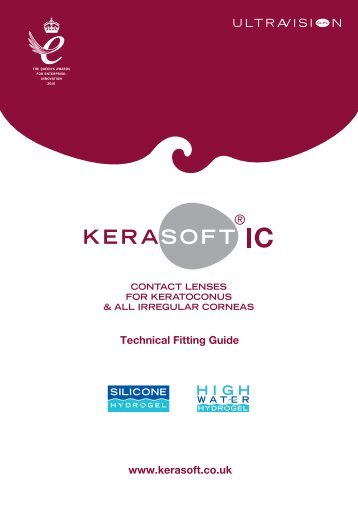 KeraSoft® IC Technical Fitting Guide - UltraVision Group