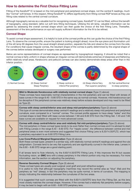 Smc Fitting Chart