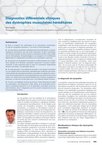 Diagnostics différentiels cliniques des dystrophies musculaires ...