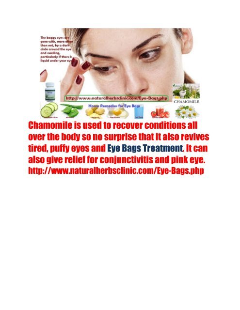 Eye Bags Treatment