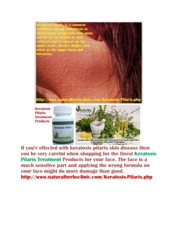 Keratosis Pilaris Treatment Products