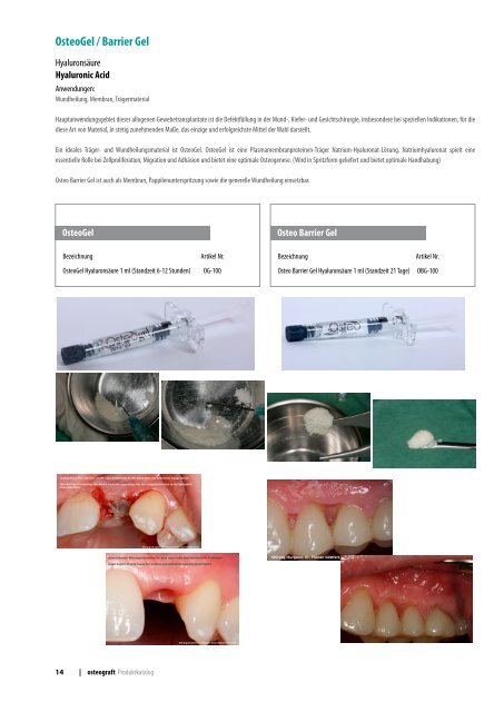 Osteograft Katalog