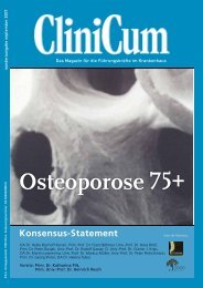 Osteoporose75+ Konsensus-Statement