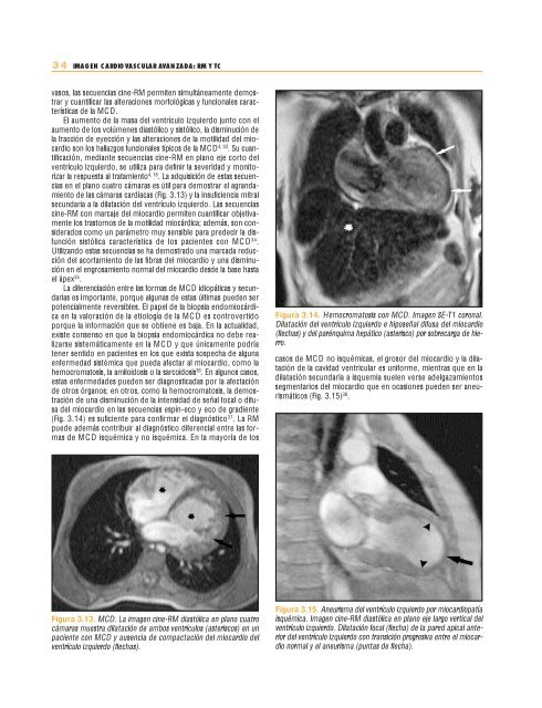 Imagen cardiovascular avanzada: RM y TC - Seram