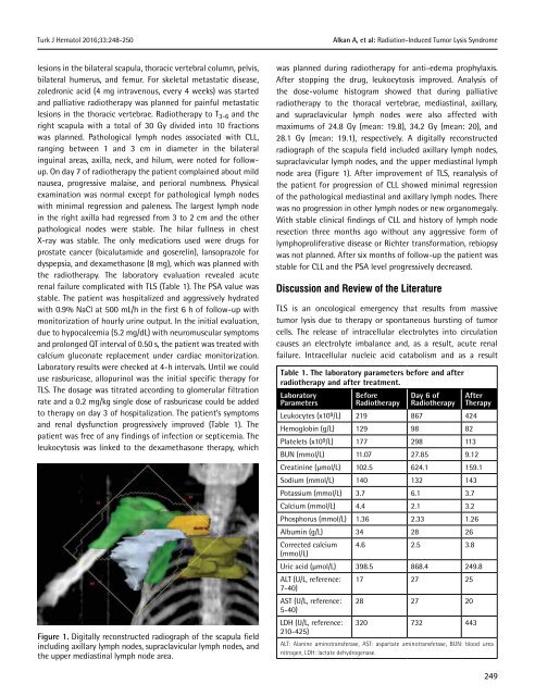 Turkish Journal of Hematology Volume: 33 - Issue: 3