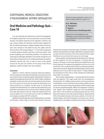 Oral Medicine and Pathology Quiz – Case 18