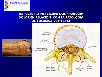 epidurolisis epidurolisis - Medicina del Dolor