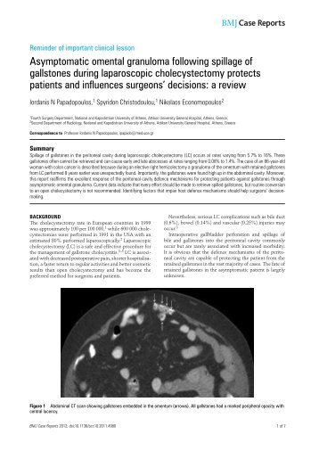 Asymptomatic omental granuloma following spillage of gallstones ...