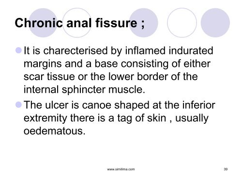 A Case Of Anal Fissure - Similima