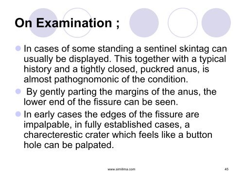 A Case Of Anal Fissure - Similima