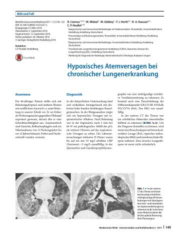 13 Hypoxisches Atemversagen bei chronischer Lungenerkrankung