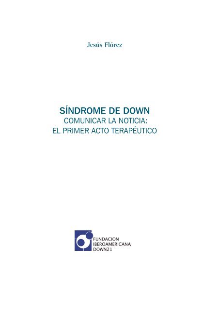 SÍNDROME DE DOWN