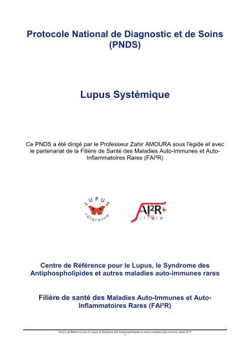 Lupus Systémique