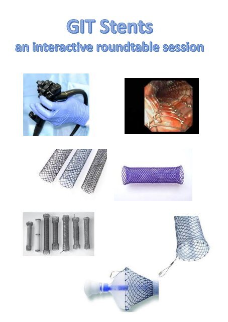 GIT stents, round table interactive session EDDW March, 29