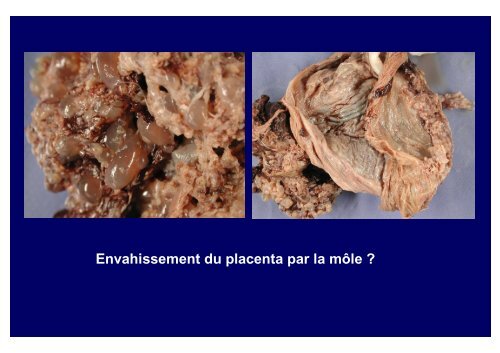 placenta p34