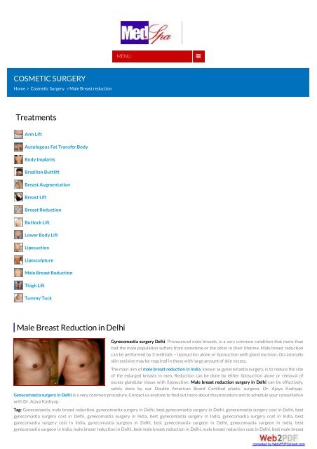 Inforgraphics Male Breast Reduction in Delhi