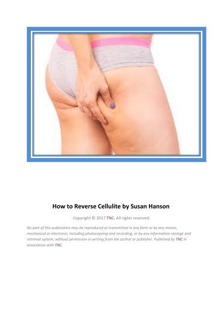How To Reduce Cellulite In Legs, Removing Cellulite From Thighs, Free  Publication