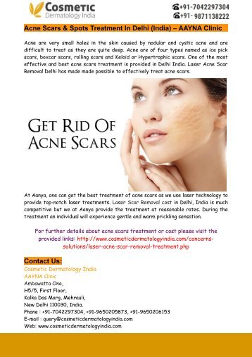 Acne Scars & Spots Treatment In Delhi (India) – AAYNA Clinic