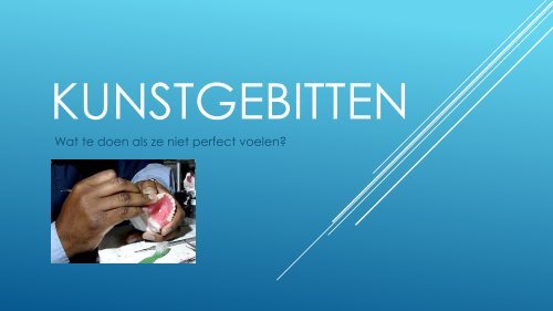 Tandprothese-Wat te doen als ze niet perfect voelt