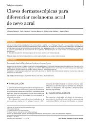 Enprensa Cesaroni-Dermatoscopía nevo acral melanoma acral