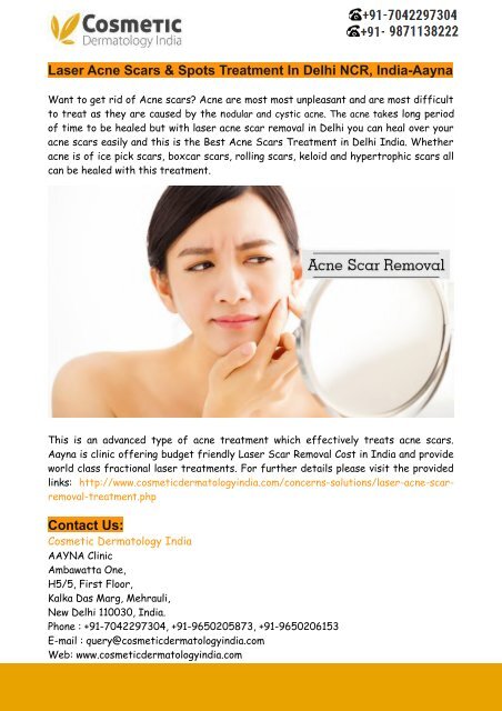 Laser Acne Scars Amp Spots Treatment In Delhi Ncr India Aayna