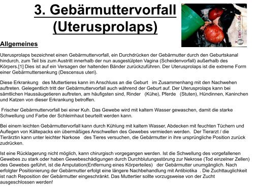 Gebärmuttervorfall