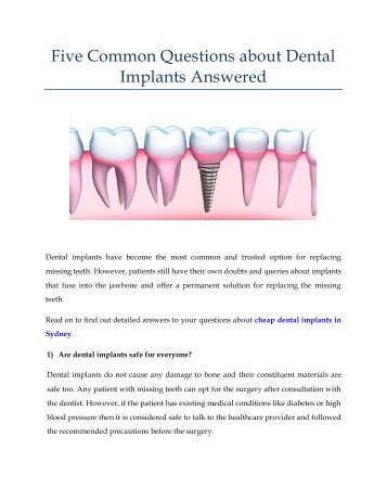 Five Common Questions about Dental Implants Answered