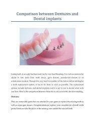 Comparison between Dentures and Dental implants