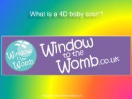 What is a 4D baby scan ?