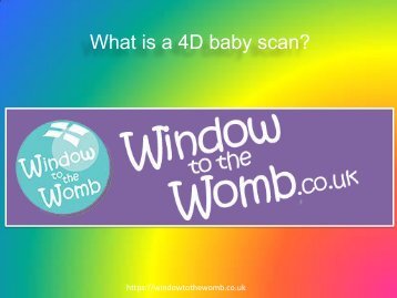What is a 4D baby scan ?
