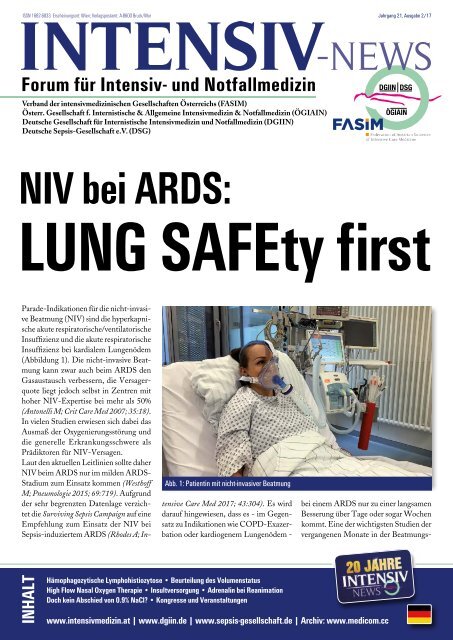 01 NIV bei ARDS