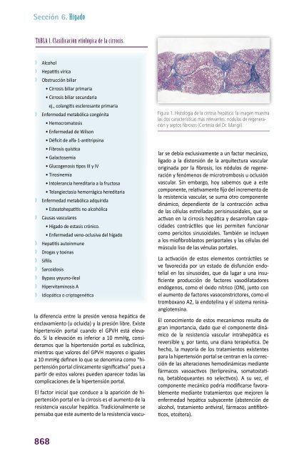 60_Cirrosis_hepatica