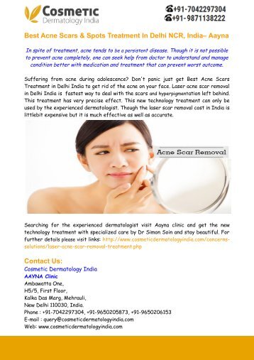 Best Acne Scars & Spots Treatment In Delhi NCR, India– Aayna