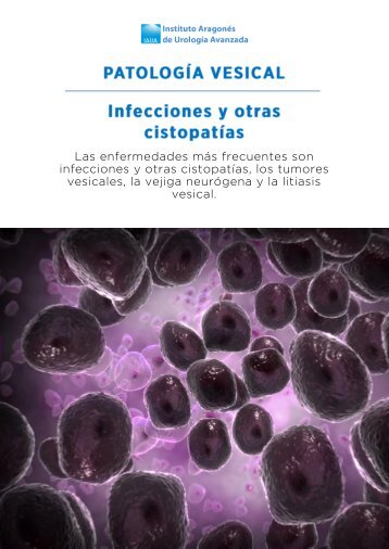 infecciones-y-otras-cistopatias