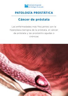 archivo pdf de próstata gleason