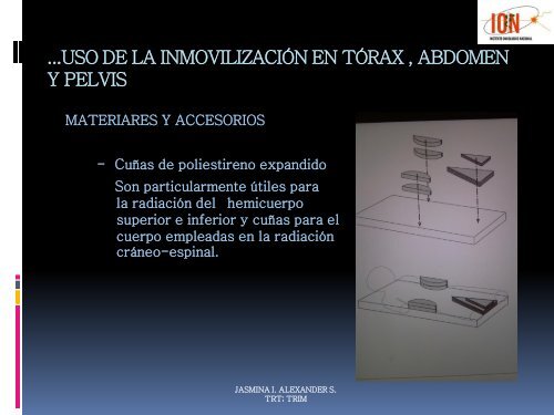 IMPORTANCIA DEL POSICIONAMIENTO EN RADIOTERAPIA