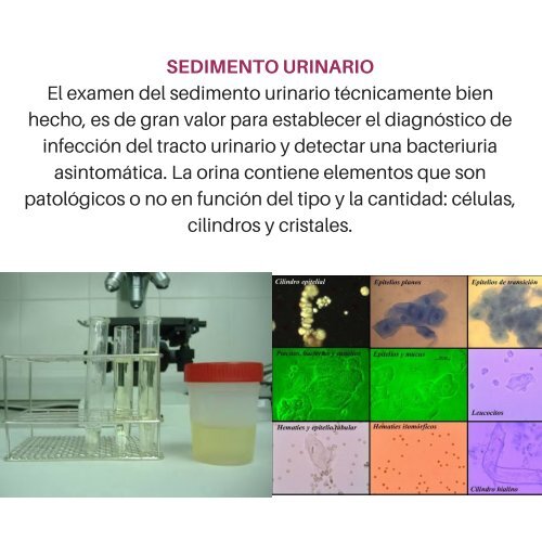 insuficiencia renal