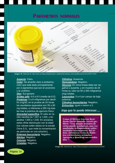 Glomerulonefritis