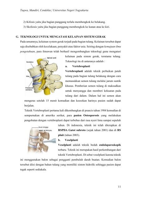 SISTEM GERAK PADA MANUSIA 1